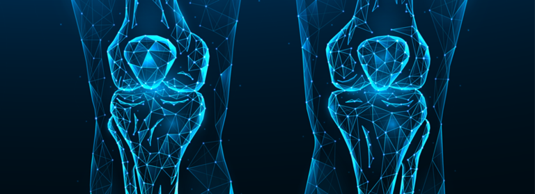 Surgical Procedures - Knee
