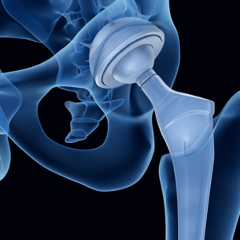Joint Preservation & Replacement